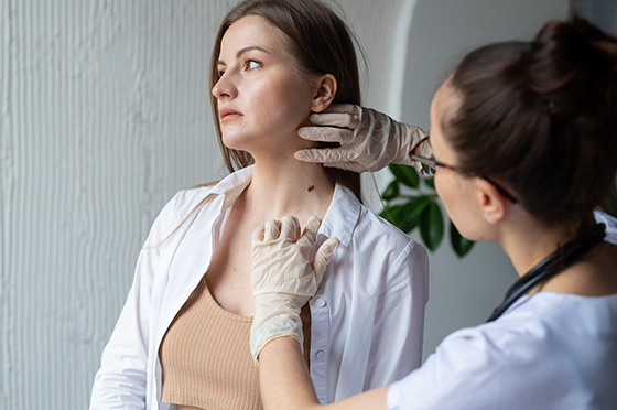 removal-of-skin-tags