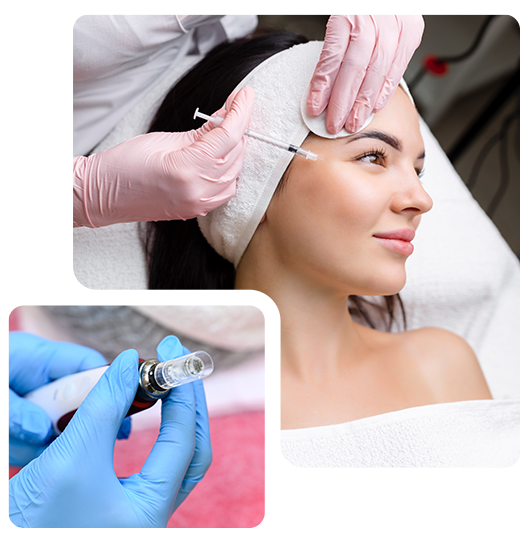 microneedlingwprp-2