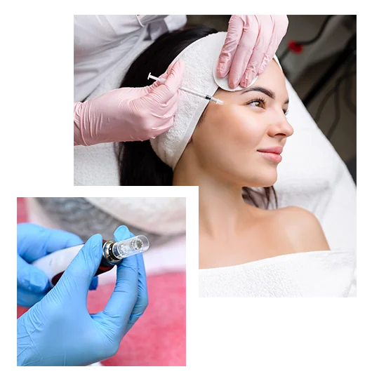 microneedlingwprp